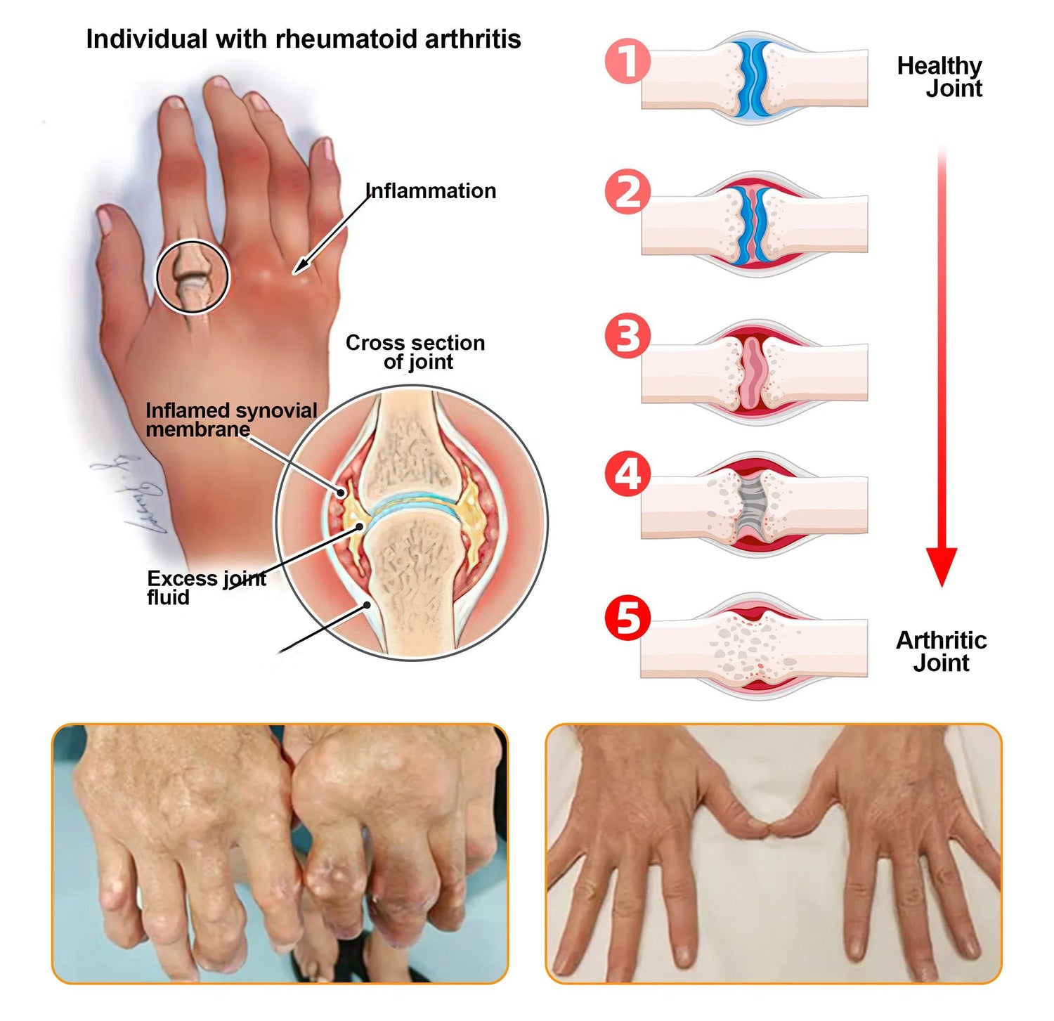 Skavix® Bee Venom Pain-Relief Bone Healing Cream