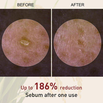 Final 3 Hours: 42% OFF🔥 Gentle Exfoliator Glow Rice Ampoule-Suitable for All Skin Types