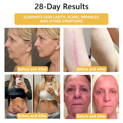 Lymphatic Activity Earrings✨28-Day Results✨🔥🔥