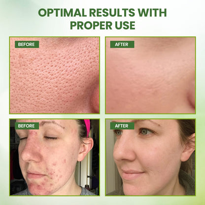 2025 New Style - Green Tea Deep Cleansing Mask