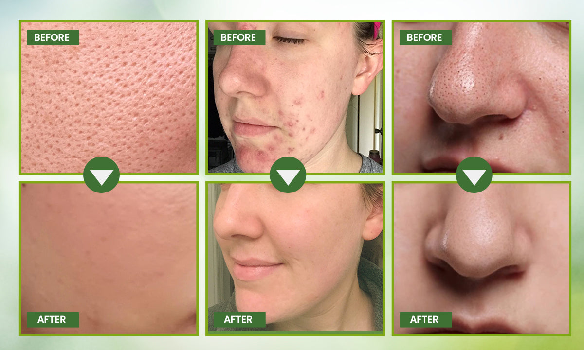 2025 New Style - Green Tea Deep Cleansing Mask